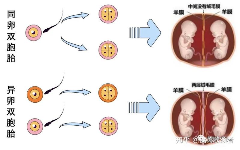 代生双胞胎_双胞胎的代生之谜